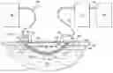 Fig. 01 - DISRUPTIVE DRESSING FOR USE WITH NEGATIVE PRESSURE AND FLUID INSTILLATION