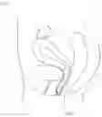 Fig. 02 - MENSTRUAL CUP CAPABLE OF BEING EASILY REMOVED