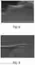 Fig. 06 - Absorbent articles comprising stretch laminates