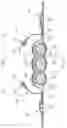 Fig. 04 - ABSORBENT ARTICLES WITH CHANNELS AND/OR POCKETS