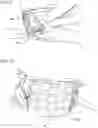 Fig. 08 - Patient mobility garment for nurses