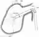 Fig. 01 - Vibratory Energy Systems and Methods for Occluded Body Cavities