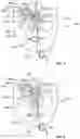 Fig. 03 - Vibratory Energy Systems and Methods for Occluded Body Cavities