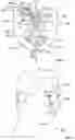 Fig. 04 - Vibratory Energy Systems and Methods for Occluded Body Cavities