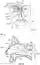 Fig. 06 - Vibratory Energy Systems and Methods for Occluded Body Cavities
