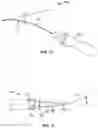 Fig. 07 - Vibratory Energy Systems and Methods for Occluded Body Cavities