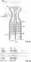 Fig. 16 - Vibratory Energy Systems and Methods for Occluded Body Cavities
