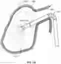 Fig. 50 - Vibratory Energy Systems and Methods for Occluded Body Cavities