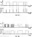 Fig. 55 - Vibratory Energy Systems and Methods for Occluded Body Cavities