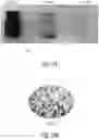Fig. 17 - PECVD coated pharmaceutical packaging