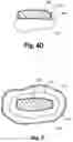 Fig. 05 - Combination Tablet With Chewable Outer Layer