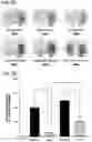 Fig. 07 - Methods of delivering a neuroprotective polypeptide to the central nervous system