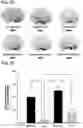Fig. 08 - Methods of delivering a neuroprotective polypeptide to the central nervous system
