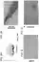 Fig. 09 - Methods of delivering a neuroprotective polypeptide to the central nervous system