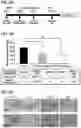 Fig. 12 - Methods of delivering a neuroprotective polypeptide to the central nervous system