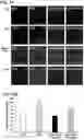 Fig. 27 - Methods of delivering a neuroprotective polypeptide to the central nervous system