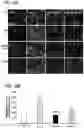Fig. 29 - Methods of delivering a neuroprotective polypeptide to the central nervous system