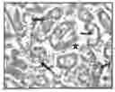 Fig. 01 - POLYMERIC NANOPARTICLES COMPRISING SALINOMYCIN