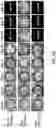Fig. 03 - IRON CHELATOR THERAPY METHOD