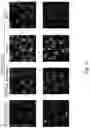 Fig. 03 - BUPROPION AND PHARMACEUTICAL COMPOSITION FOR TREATING CANCER AND METHOD FOR INHIBITING MIGRATION OF TUMOR CELLS
