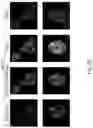 Fig. 06 - BUPROPION AND PHARMACEUTICAL COMPOSITION FOR TREATING CANCER AND METHOD FOR INHIBITING MIGRATION OF TUMOR CELLS