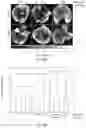 Fig. 15 - BUPROPION AND PHARMACEUTICAL COMPOSITION FOR TREATING CANCER AND METHOD FOR INHIBITING MIGRATION OF TUMOR CELLS
