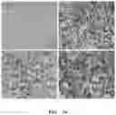 Fig. 14 - PHARMACEUTICAL COMPOSITION FOR INDUCING EXERCISE MIMETIC EFFECT