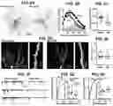 Fig. 06 - Methods and compositions for treating pain