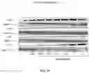 Fig. 16 - Methods and compositions for inhibition of EGF/EGFR pathway in combination with anaplastic lymphoma kinase inhibitors