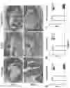 Fig. 14 - Lanthionine synthetase C-like 2-based therapeutics