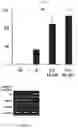 Fig. 11 - Composition for inducing differentiation and protection of neural stem cells and method for inducing neuro-regeneration using the same composition