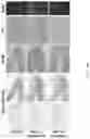 Fig. 27 - Composition for inducing differentiation and protection of neural stem cells and method for inducing neuro-regeneration using the same composition