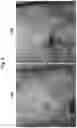 Fig. 04 - Topical formulation for a JAK inhibitor
