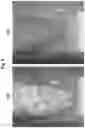Fig. 06 - Topical formulation for a JAK inhibitor