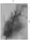 Fig. 07 - Medicament for Treating Peripheral Neuropathies
