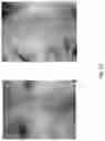 Fig. 14 - Medicament for Treating Peripheral Neuropathies