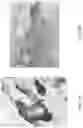 Fig. 16 - Medicament for Treating Peripheral Neuropathies