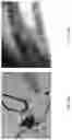Fig. 19 - Medicament for Treating Peripheral Neuropathies