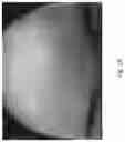 Fig. 20 - Medicament for Treating Peripheral Neuropathies