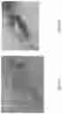 Fig. 22 - Medicament for Treating Peripheral Neuropathies