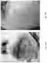 Fig. 24 - Medicament for Treating Peripheral Neuropathies