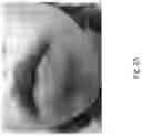 Fig. 26 - Medicament for Treating Peripheral Neuropathies