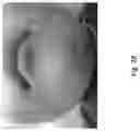 Fig. 29 - Medicament for Treating Peripheral Neuropathies