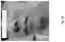 Fig. 30 - Medicament for Treating Peripheral Neuropathies