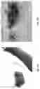 Fig. 34 - Medicament for Treating Peripheral Neuropathies