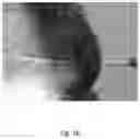 Fig. 37 - Medicament for Treating Peripheral Neuropathies