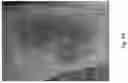 Fig. 41 - Medicament for Treating Peripheral Neuropathies