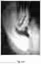 Fig. 45 - Medicament for Treating Peripheral Neuropathies