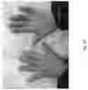 Fig. 48 - Medicament for Treating Peripheral Neuropathies