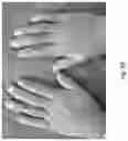 Fig. 50 - Medicament for Treating Peripheral Neuropathies